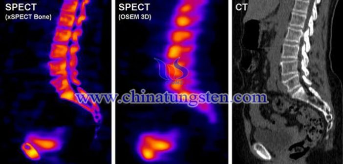 高比重鎢合金準直器用于SPECT系統(tǒng)圖片